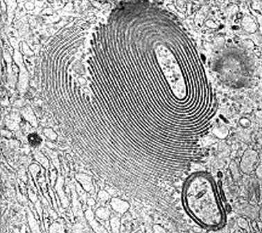 imagen microscopio electronico